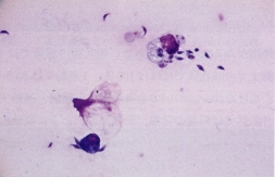 図1.三日月型を呈する増殖型原虫，ギムザ染色